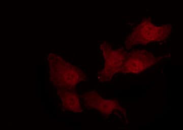 Polyclonal Rabbit anti-Human MMP14 Antibody (IHC, IF, WB)