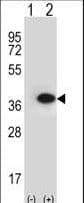 IHC-plus™ ANXA2 / Annexin A2 Antibody (aa19-49)
