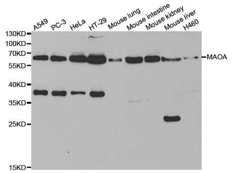 IHC-plus™ Polyclonal Rabbit anti-Human MAOA / Monoamine Oxidase Antibody (IHC, WB)