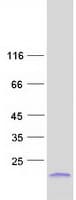 Human SPRR2F Protein (Recombinant Myc-DDK (Flag))