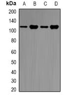 E6AP / UBE3A Antibody