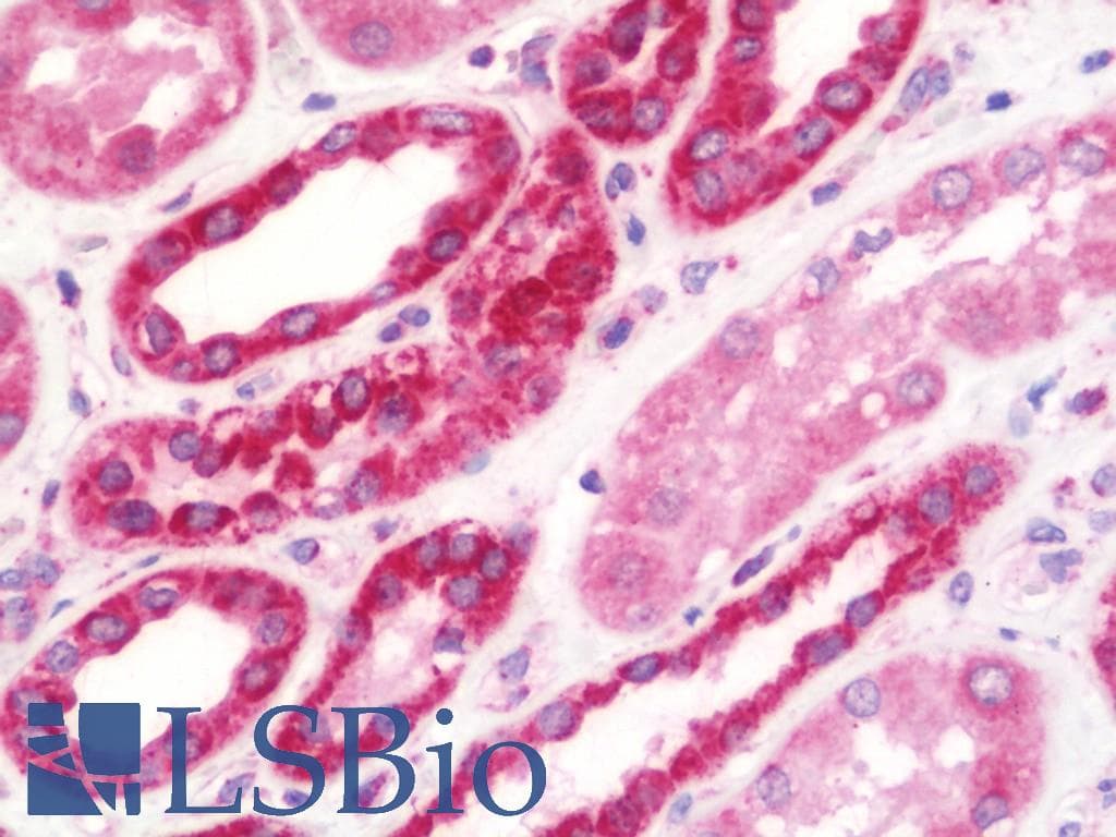 IHC-plus™ NDUFS2 Antibody (aa200-430)