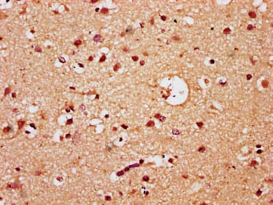 TCF20 Antibody