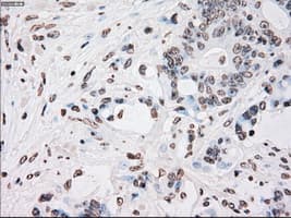 PLK1 / PLK-1 Antibody (clone OTI1A2)