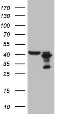 PLCXD1 Antibody (clone OTI2D7)