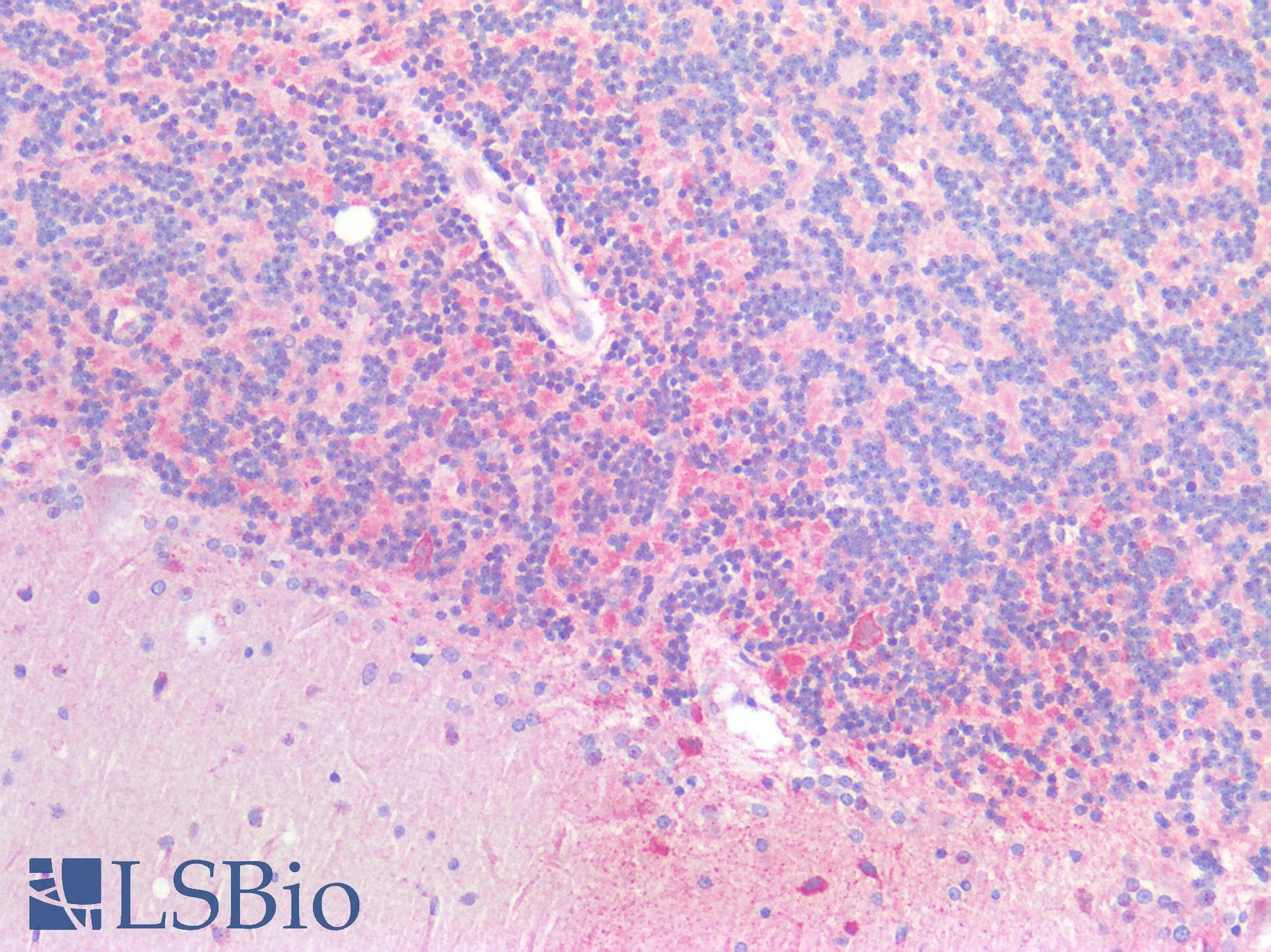 IHC-plus™ Polyclonal Rabbit anti-Human HTR1A / 5-HT1A Receptor Antibody (IHC, WB)