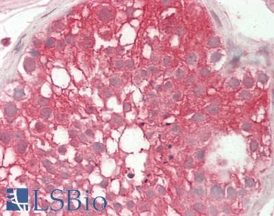 IHC-plus™ Polyclonal Rabbit anti-Human SRPK1 Antibody (IHC, WB)