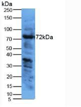 KNG1 / Kininogen / Bradykinin Antibody (aa22-379)