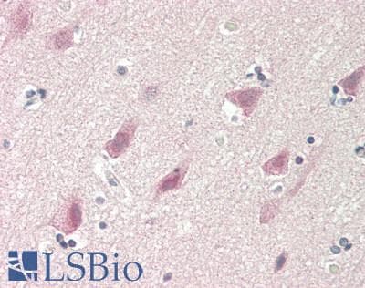 IHC-plus™ RPS6KB2 / S6K2 Antibody (clone 4B11)