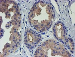 VCAM1 / CD106 Antibody (clone OTI5B12)