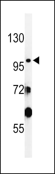 Polyclonal Rabbit anti-Human INPP5F Antibody (aa133-161, WB)