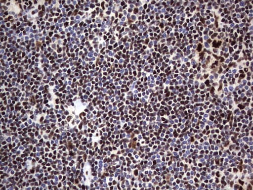 DDX56 Antibody (aa323-547, clone UMAB152)