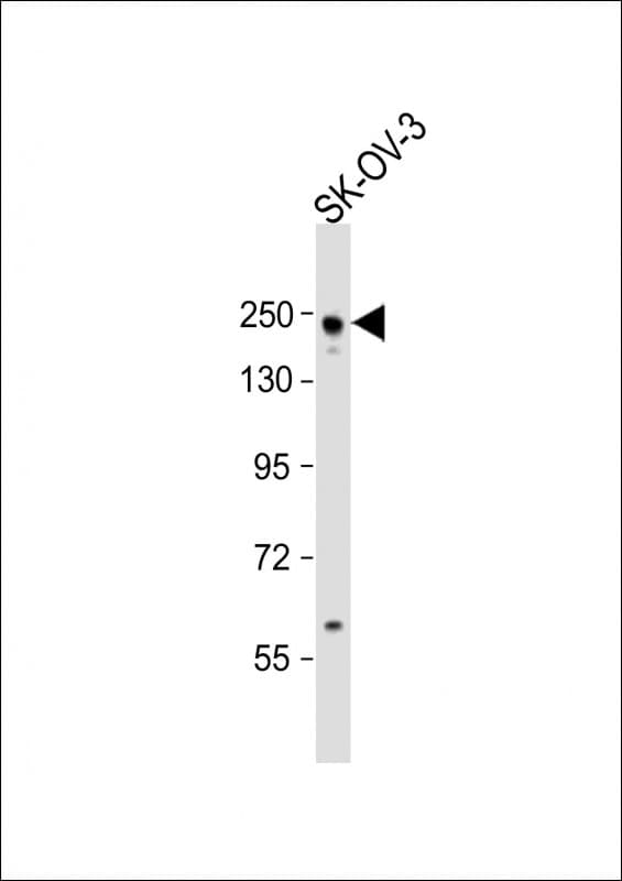ARID1A / BAF250 Antibody (aa1717-1750)