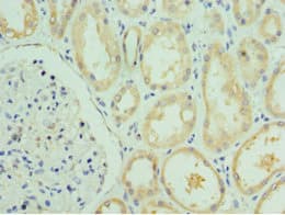 VIPERIN / RSAD2 Antibody (aa42-361)