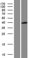 NIPA2 Protein (Over-Expression Lysate Myc-DDK (Flag))