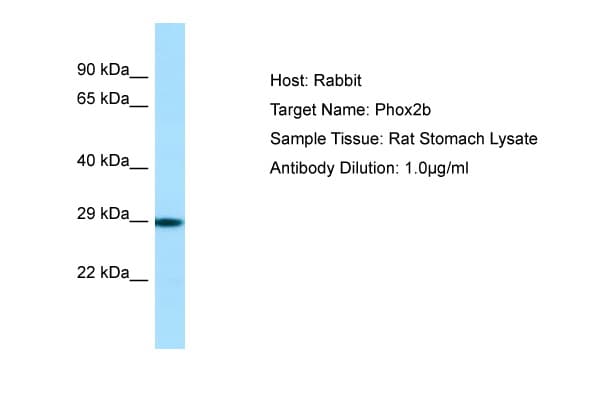 PHOX2B Antibody (N-Terminus)