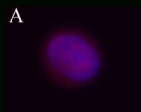 IHC-plus™ Tuberin / TSC2 Antibody (phospho-Ser664)