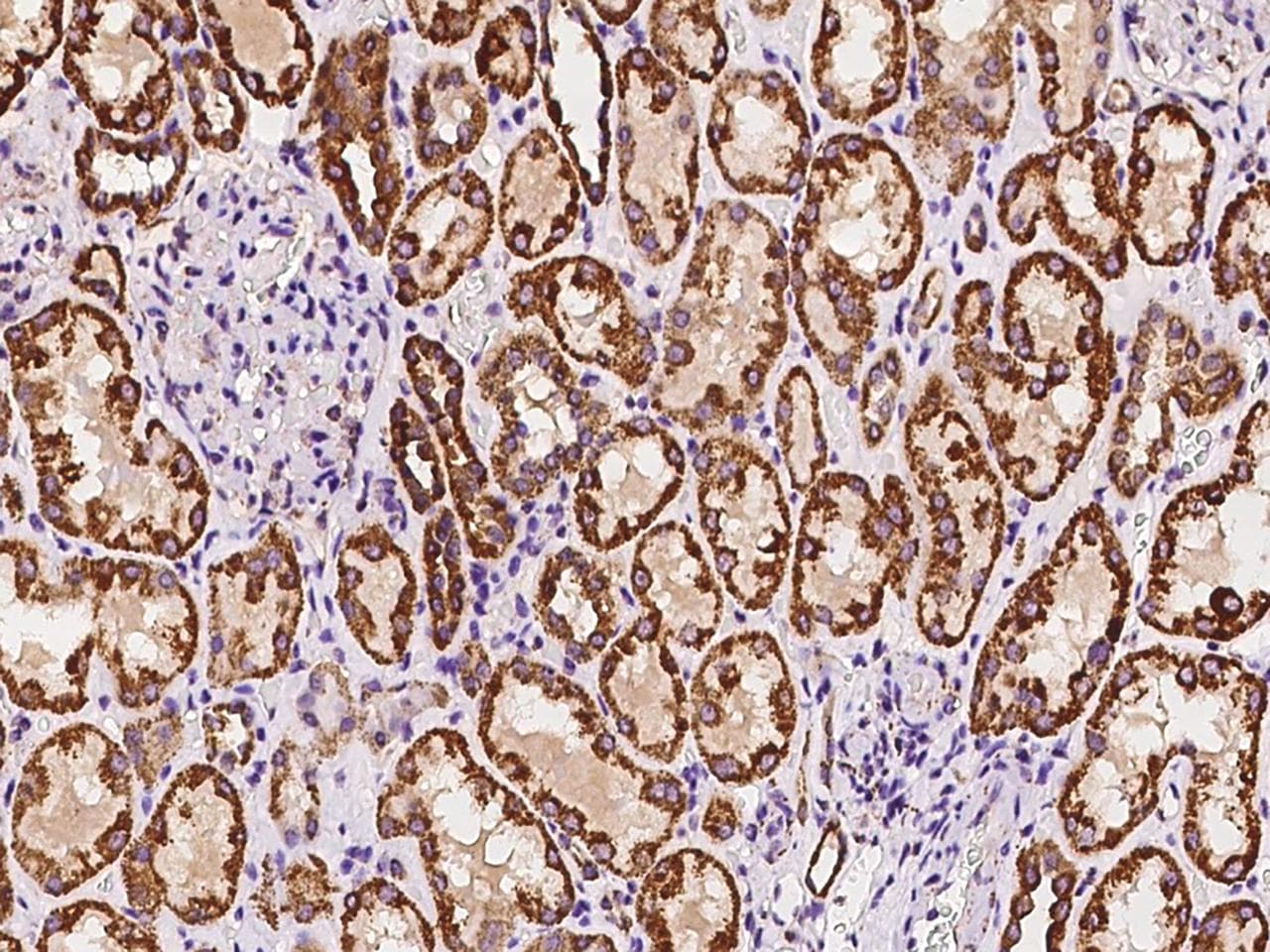 PSMF1 Antibody