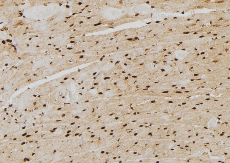 PSMB4 Antibody