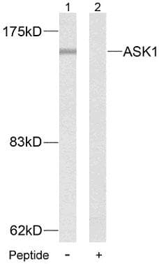 Polyclonal Rabbit anti-Human MAP3K5 / ASK1 Antibody (p83, IHC, WB)