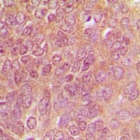 TPH1 / Tryptophan Hydroxylase Antibody (Internal)