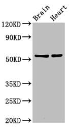 RBM45 / DRB1 Antibody