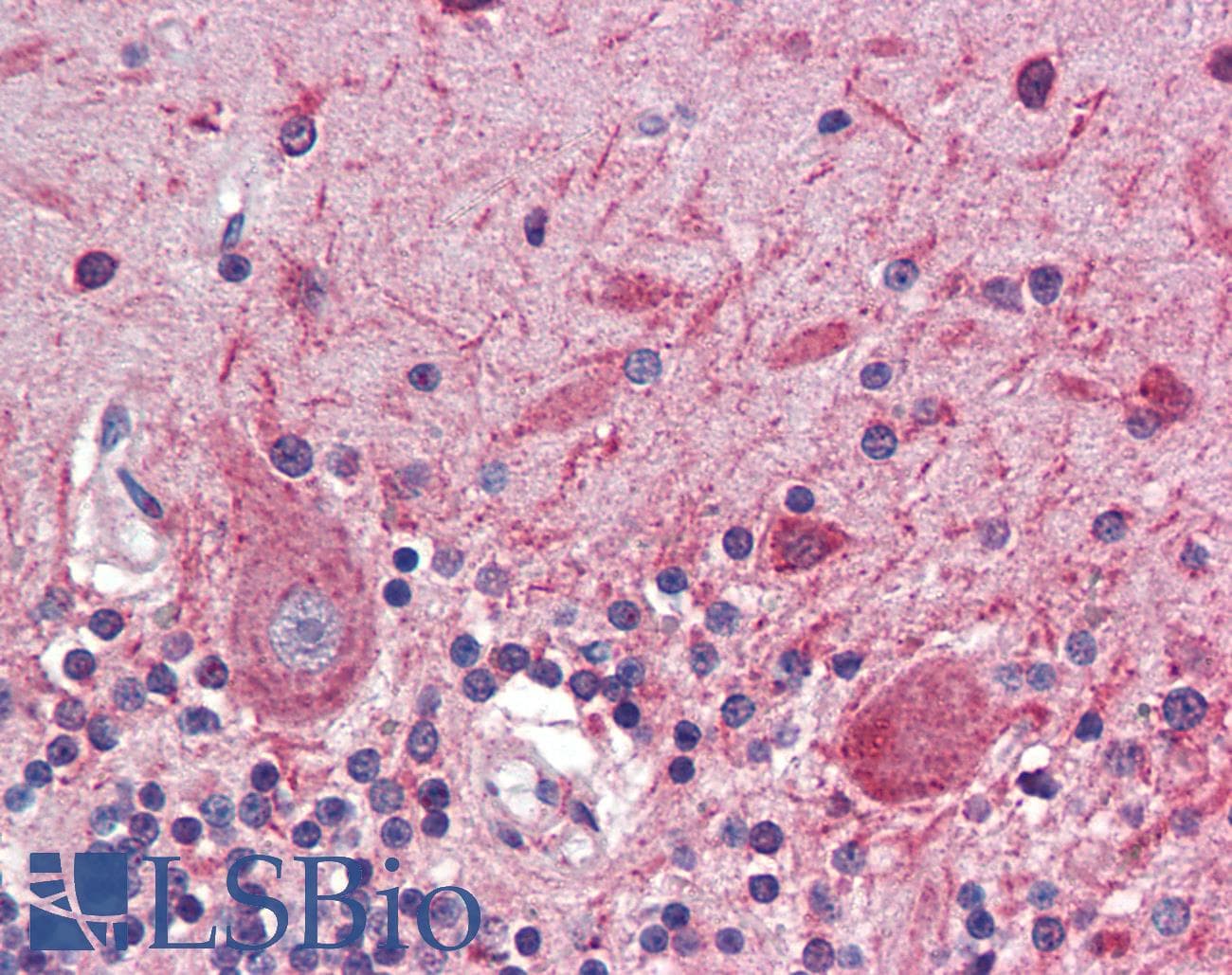 Polyclonal Rabbit anti-Mouse ATF4 Antibody (N-Terminus, IHC, WB)