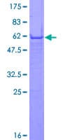 Human IFI35 Protein (Recombinant GST)