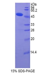 Human COL14A1 / Collagen XIV Protein (Recombinant His-GST)
