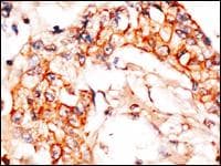 NAE1 / APPBP1 Antibody (aa430-459)