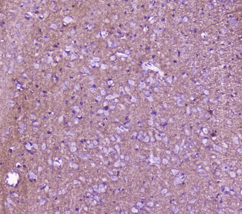 Polyclonal Rabbit anti-Human SNAP25 Antibody (IHC, WB)