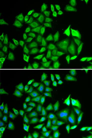 IHC-plus™ PSMA3 Antibody