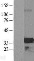 ZMAT4 Protein (Over-Expression Lysate Myc-DDK (Flag))