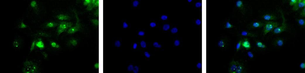 TP53BP1 / 53BP1 Antibody (C-Terminus, Biotin)