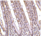 Gestrinone Antibody