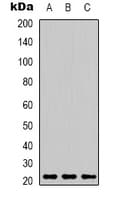IHC-plus™ Monoclonal Mouse anti-Human PRDX1 / Peroxiredoxin 1 Antibody (IHC, IF, WB)
