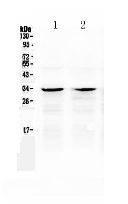 CASP6 / Caspase 6 Antibody