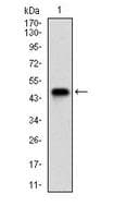 NBN / Nibrin Antibody (aa400-650, clone 7E4A2)