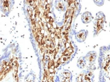 Monoclonal Mouse anti-Human S100A4 / FSP1 Antibody (clone S100A4/1482, Azide-free,BSA-free, IHC, IF, WB)