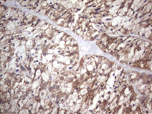 Monoclonal Mouse anti-Human PIK3CA / PI3K Alpha Antibody (clone OTI8D6, aa303-631, IHC)