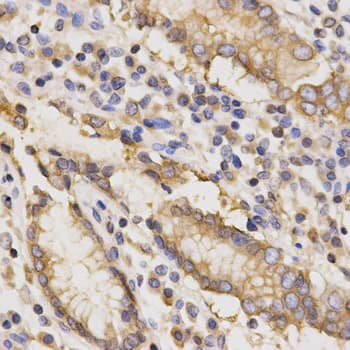 TAPBP / Tapasin Antibody