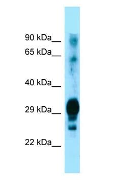 GPM6A / Glycoprotein M6A Antibody (C-Terminus, HRP)