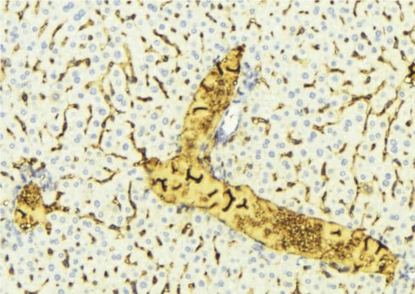 Polyclonal Rabbit anti-Human EHHADH / Enoyl-Coa Hydratase Antibody (IHC, IF, WB)