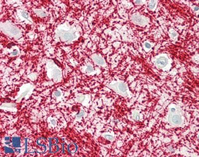 PathPlus™ CNPase Antibody