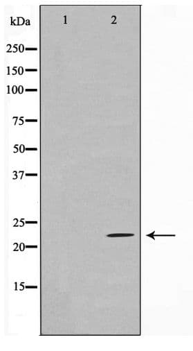 CD69 Antibody