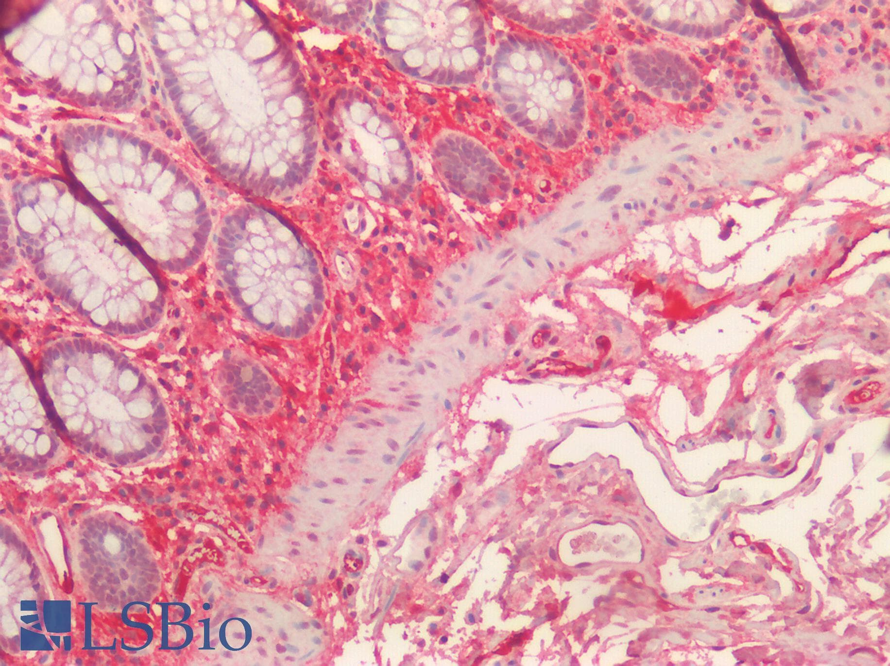 SCN9A / Nav1.7 Antibody