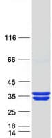 Human HMGCL Protein (Recombinant Myc-DDK (Flag))