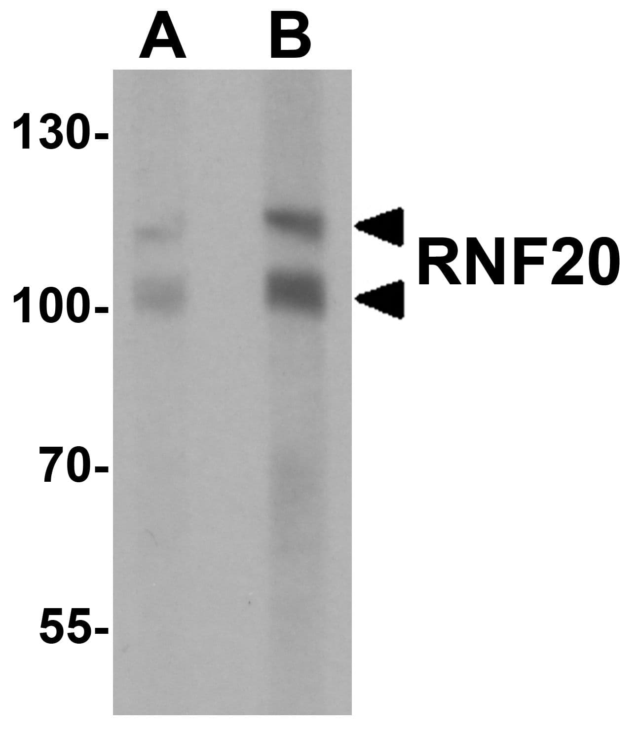 IHC-plus™ RNF20 Antibody