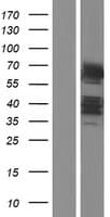 DTX2 Protein (Over-Expression Lysate Myc-DDK (Flag))