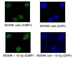 IHC-plus™ TP53BP1 / 53BP1 Antibody (aa350-400)
